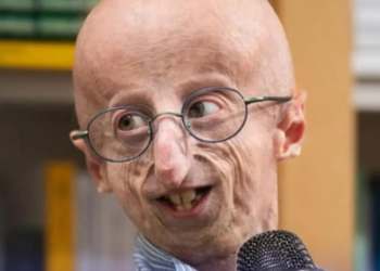 Fallece Sammy Basso, el científico que vivió con progeria