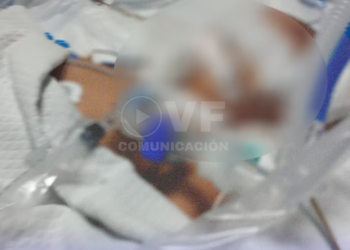 Niño de 4 años está en UCI luego de caer de una resbaladera en plantel de Guayaquil