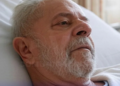 Lula da Silva será sometido a una nueva operación para detener una hemorragia cerebral