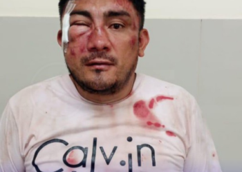 CIRUGÍA GRATUITA PARA DELINCUENTE ARMADO