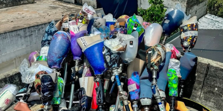 El youtuber MrBeast donó 50 prótesis durante su visita a Ecuador