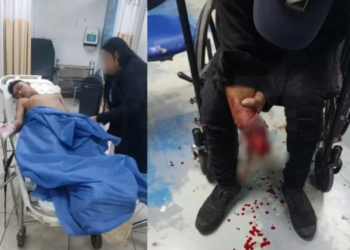 Extorsionador pierde dedos y parte del brazo al explotarle artefacto en Guayaquil