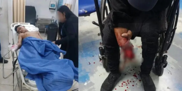 Extorsionador pierde dedos y parte del brazo al explotarle artefacto en Guayaquil