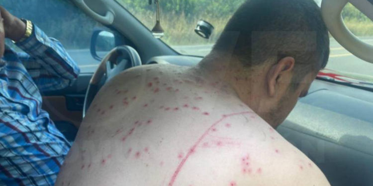 Un ataque de abejas en la vía Santa Elena-Guayaquil deja al menos tres afectados